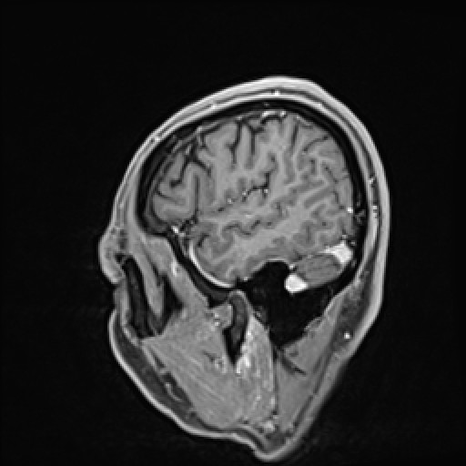 Click on the Serie image to view the images of VILLANUEVA, WILLIAM A.